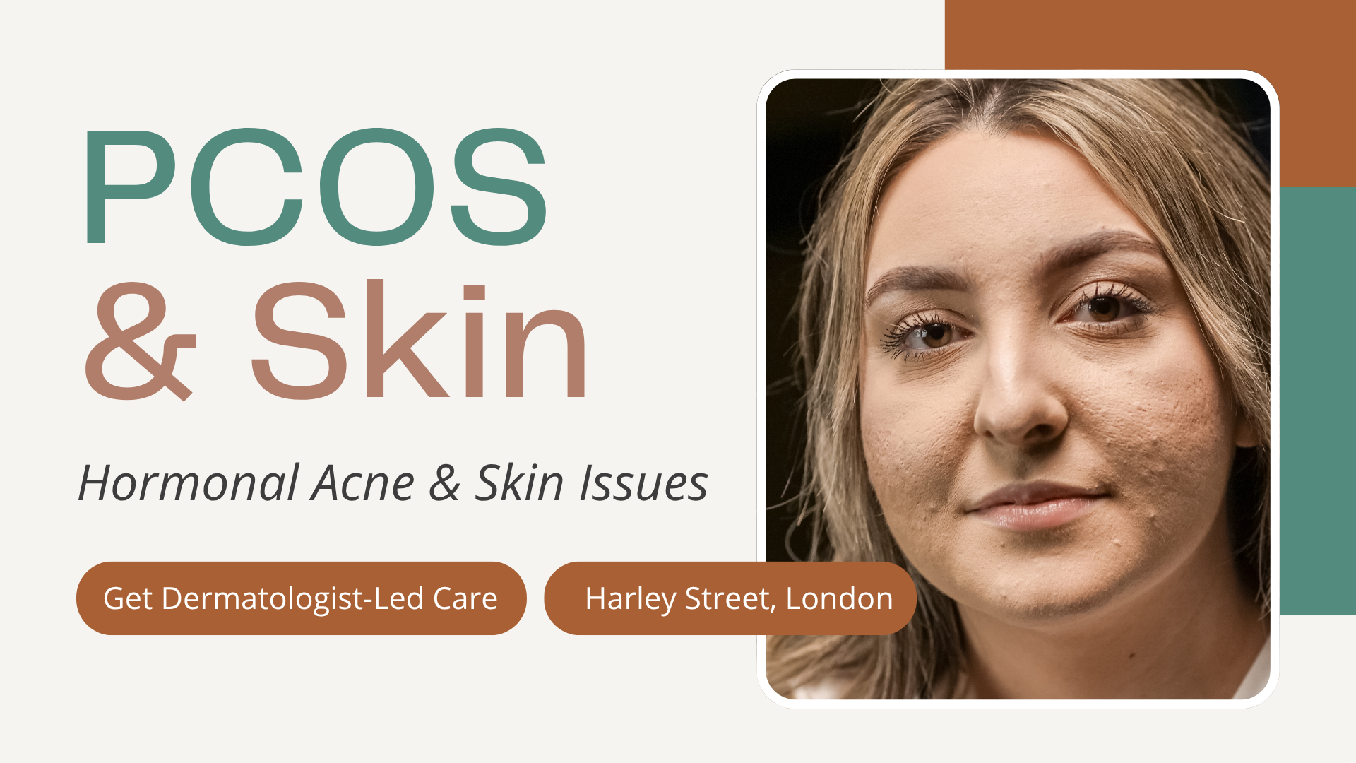 PCOS & Skin