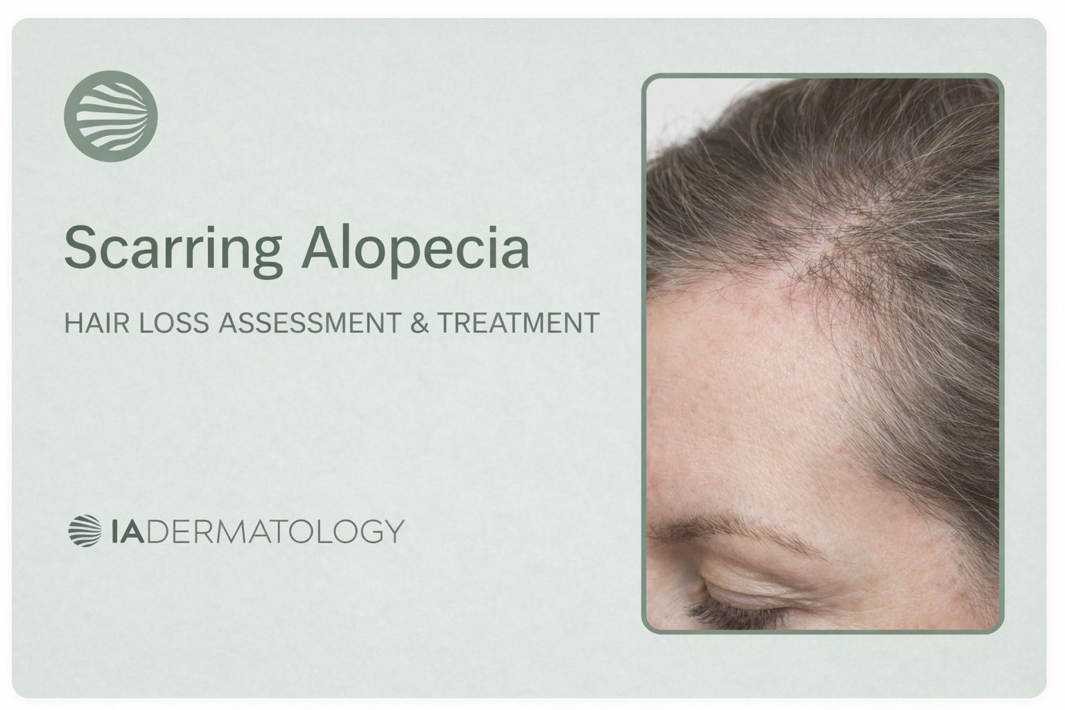 Scarring Alopecia
