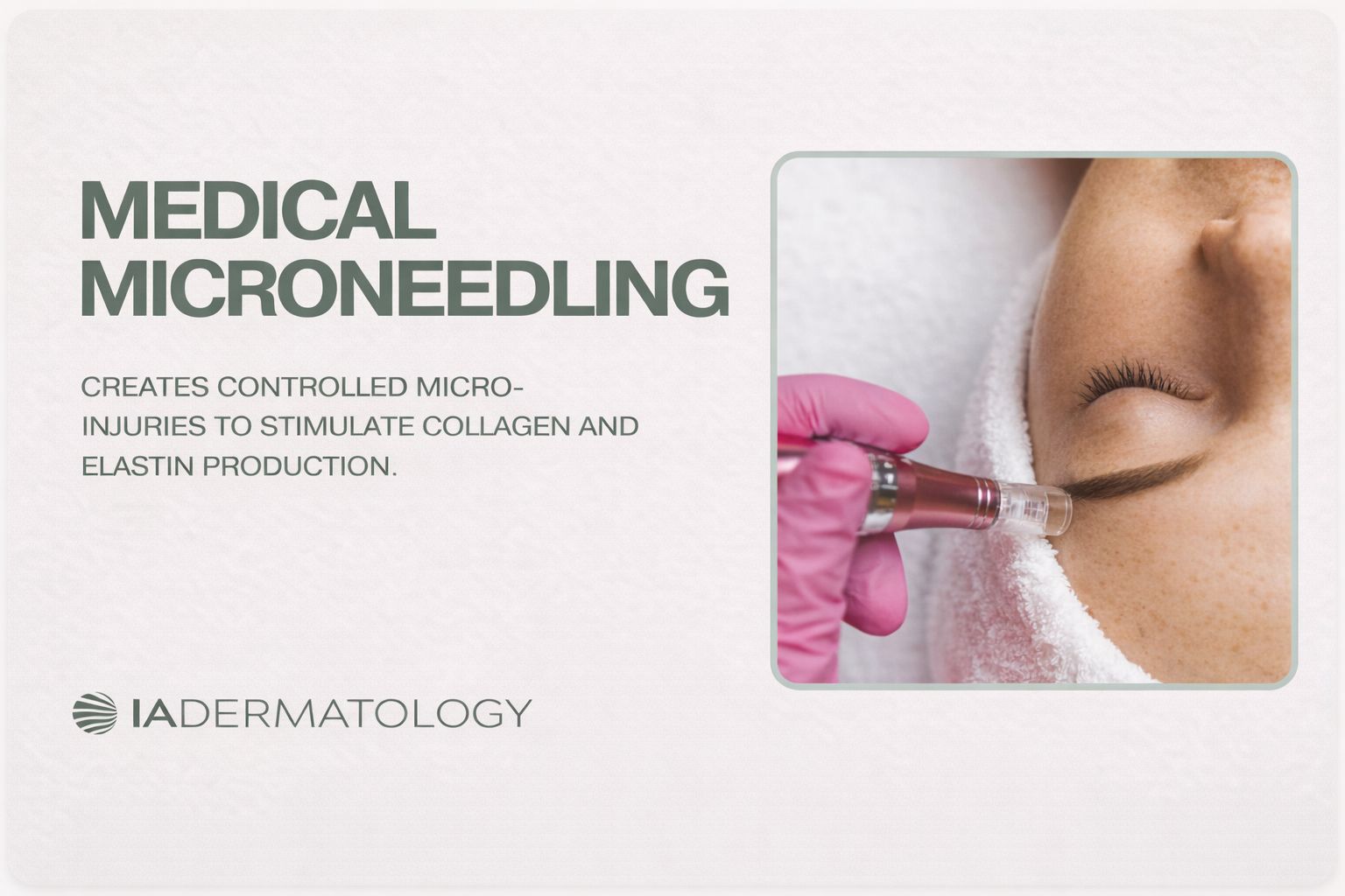 Dermapen Microneedling at IADermatology, Harley Street, London