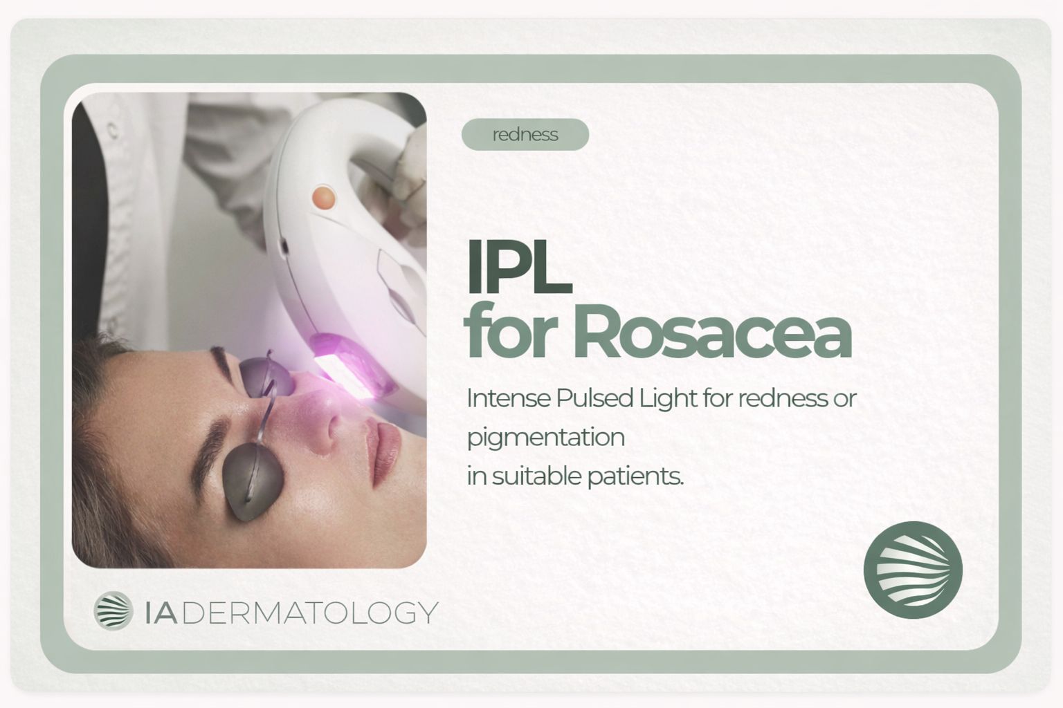 IPL - Intense Pulsed Light to Reduce Rosacea Redness