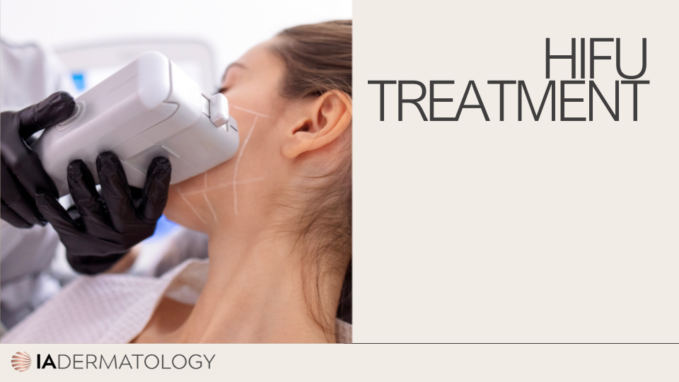 HIFU treatment for Non-Surgical Skin Tightening