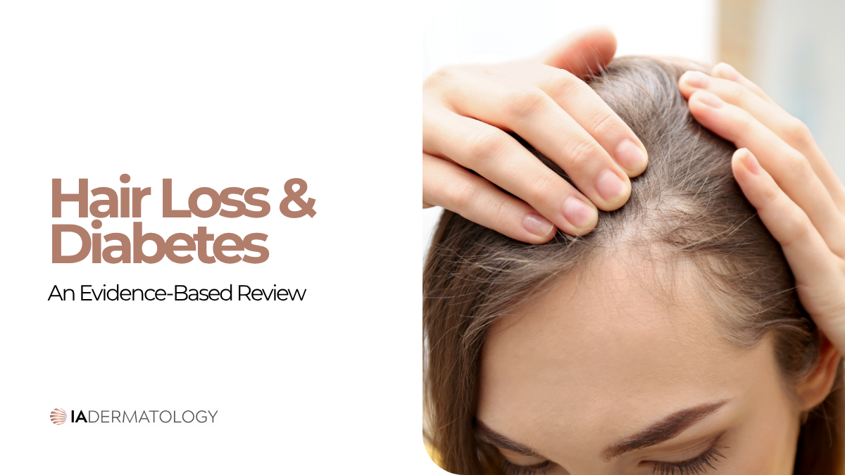 Hair Loss and Diabetes: An Evidence-Based Review